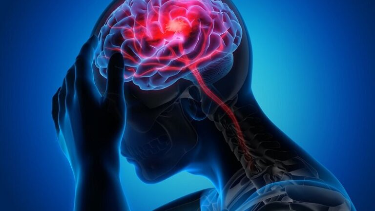 راهکارهای پیشگیری از سکته مغزی