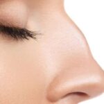 قوز بینی چیست و چرا ایجاد می‌شود؟