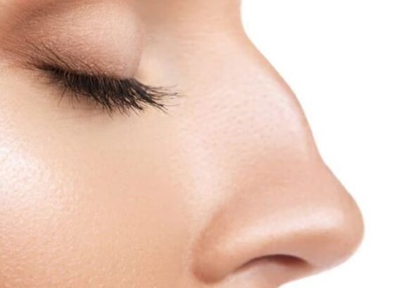 قوز بینی چیست و چرا ایجاد می‌شود؟