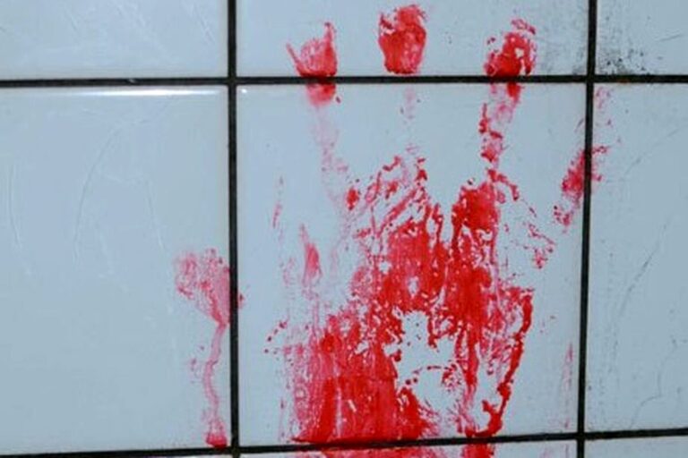 قاچاق هولناک اعضای بدن در تهران