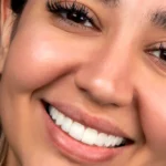 راز لبخندی جاودان با اصلاح طرح لبخند