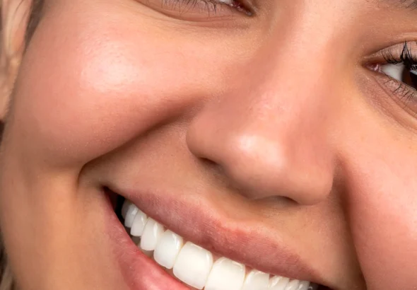 راز لبخندی جاودان با اصلاح طرح لبخند