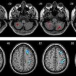 پاسخ نتیجه MRI فقط در چند ثانیه!