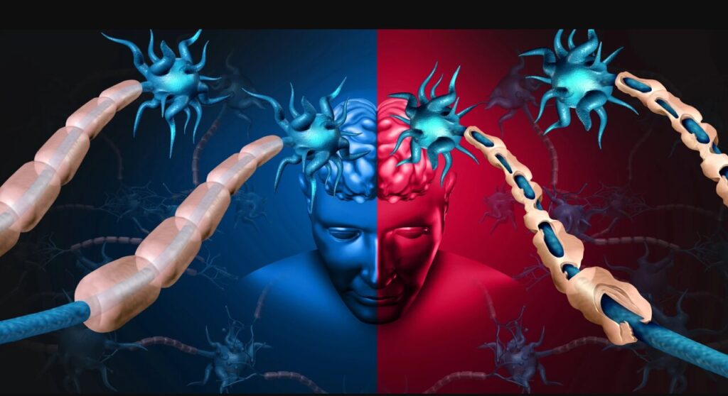 یافته‌های جدید درباره ام‌اس